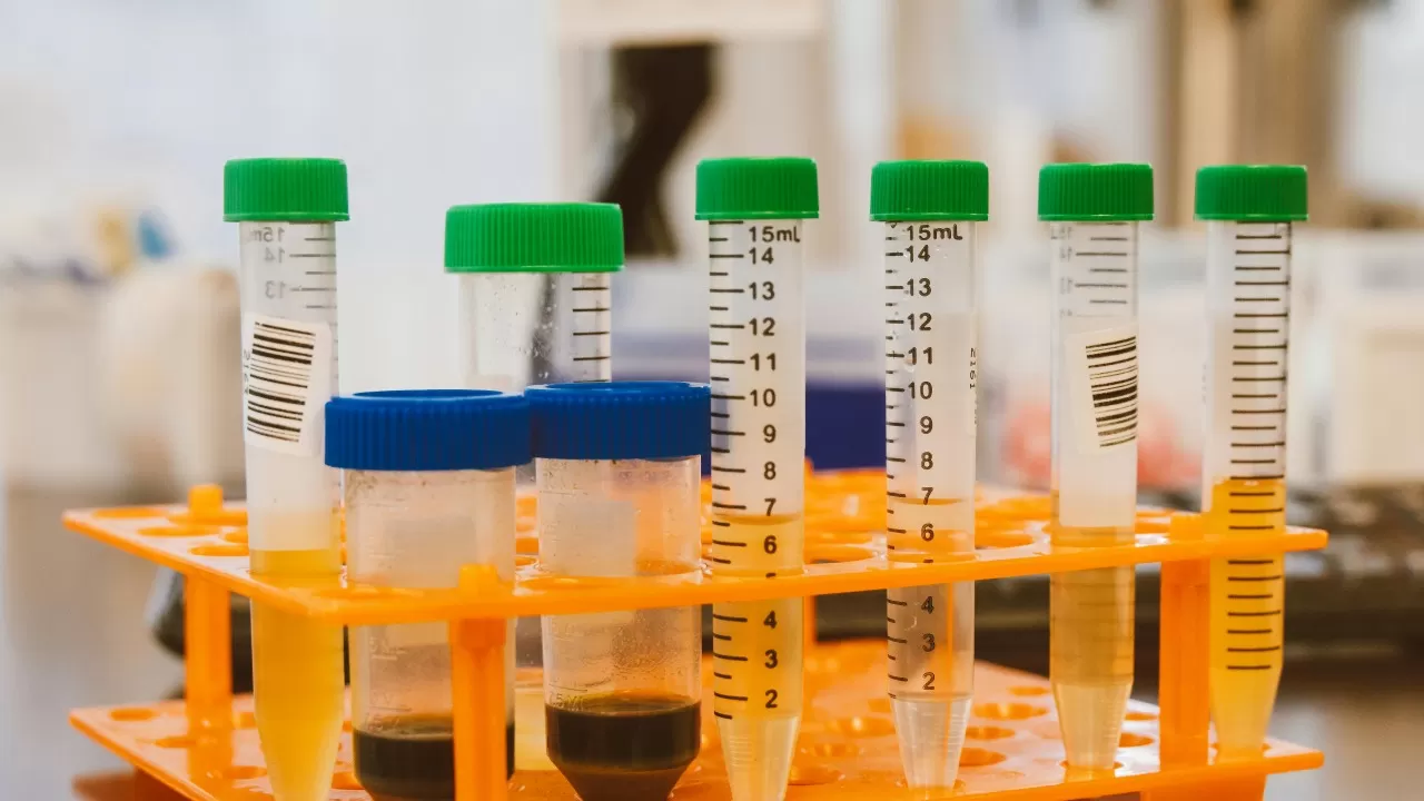 Are there differences between 